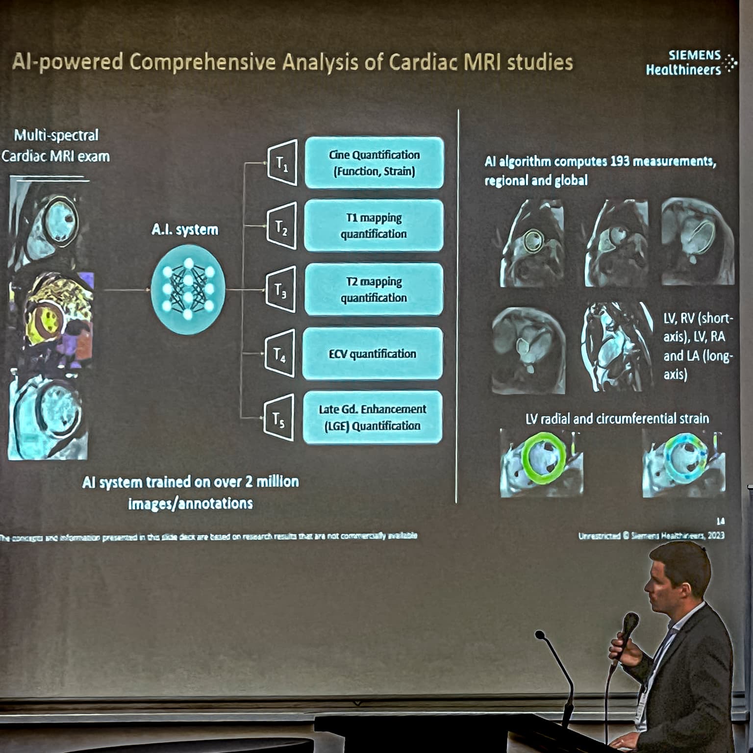 Lucian Itu - AI-powered comprehensive analysis of cardiac MRI studies